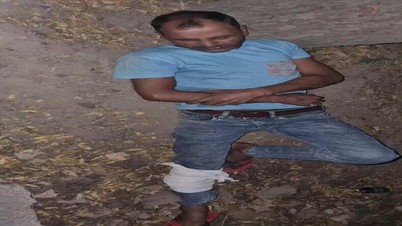 Noida News: नोएडा के थाना फेस 2 पुलिस व बदमाशों के बीच हुई मुठभेड़ एक बदमाश घायल