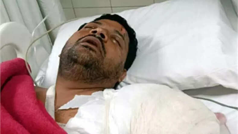  कचौड़ी खाने के बाद पैसे मांगने पर युवक ने दुकानदार पर पलट दी खौलते तेल की कढ़ाई